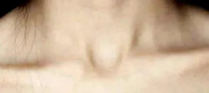 maxilar