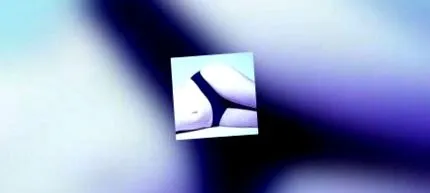 cellulit