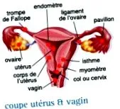 infocancer arcagy-gineco