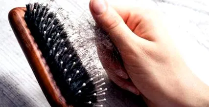 alopecie areata cauză