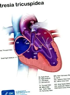 tricuspid