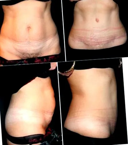 chirurgie