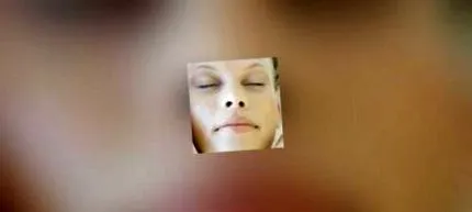 mesolift