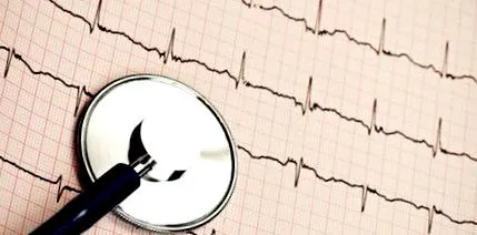 elektrokardiogram