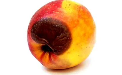 nyomásfekélyek