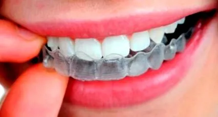 CASHER DENTAL
