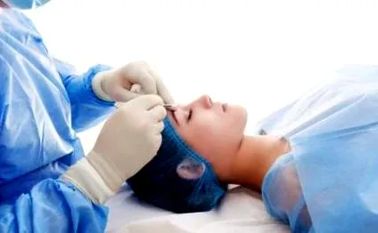 blefaroplastie