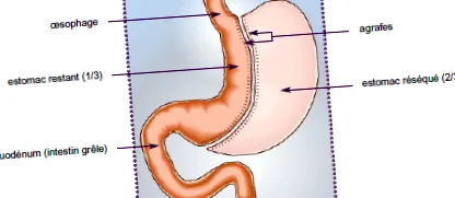 obezitatea