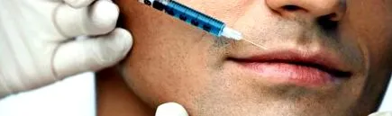 injecție
