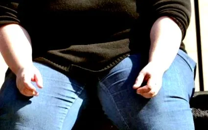 lipoliză