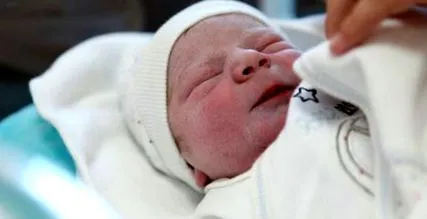 vernix caseosa