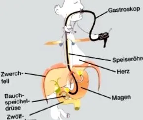 gyomor