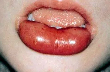 овие