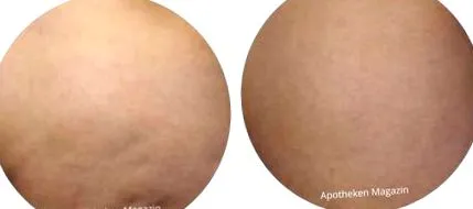 elleni