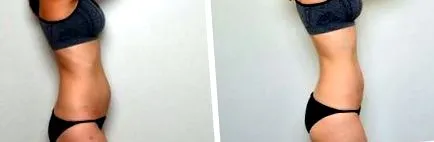 маснотиите ослободете