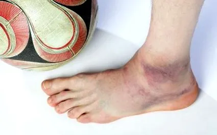 ligamentul