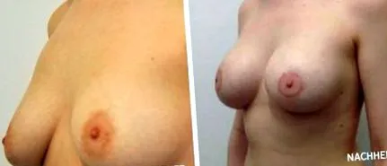euróba kerül