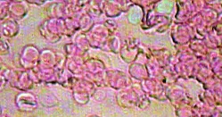 coral-mine corali