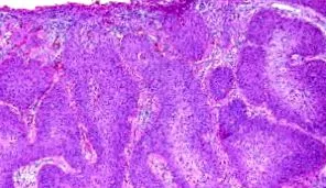 eccrin
