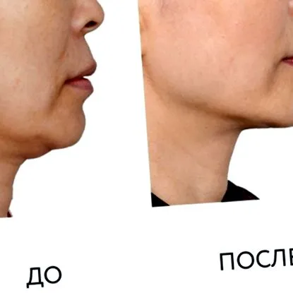 мислењата