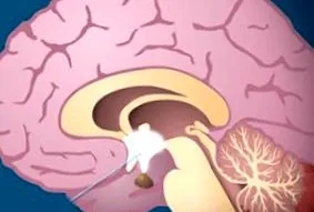 neuroendocrină