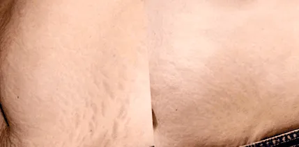 MARK REMOVER