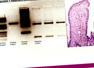 duodenum