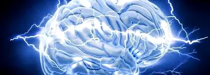 nootropic supliment