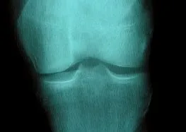 2012