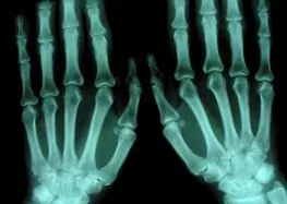року