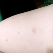 sandriabetes
