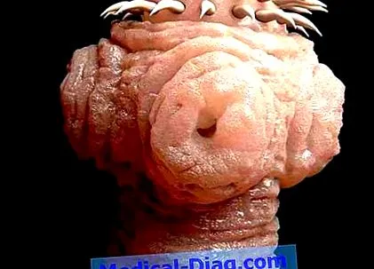 aggódnunk
