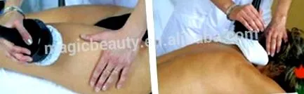 cellulit