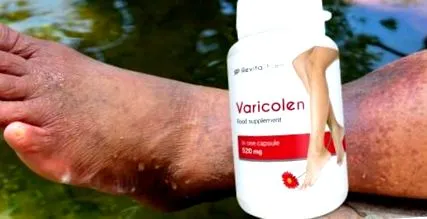 vásároljon varicolen