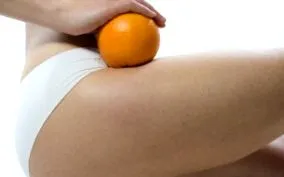 ráncok