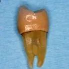 dentare