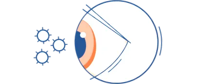 szemallergia