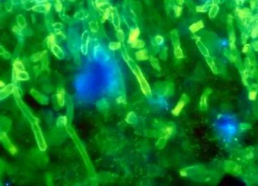 Candida albicans