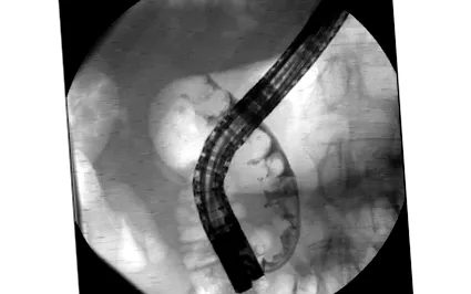 diagnostic