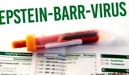 vírus