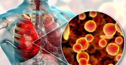 mycoplasma