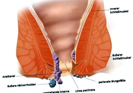 aranyérről