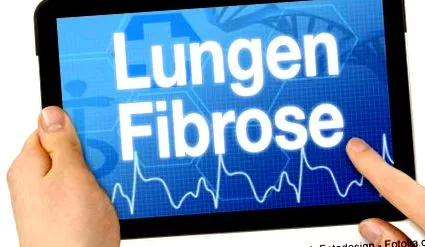 fibroza