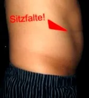 belly