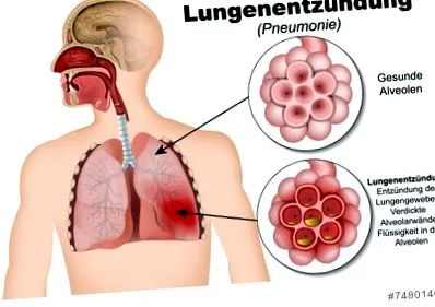 tájékoztassa gyógyszertárát