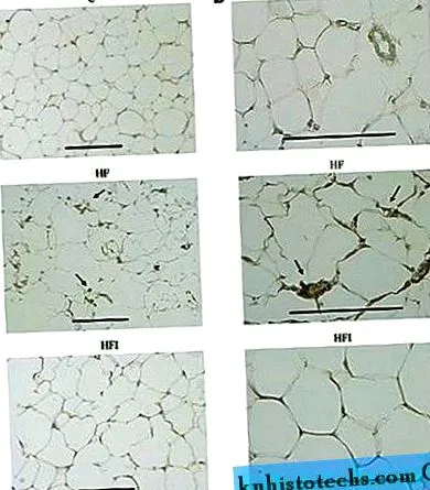 gyulladással