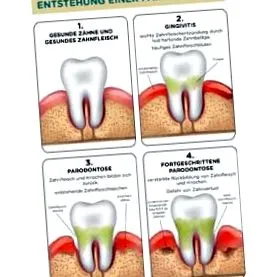 dentară