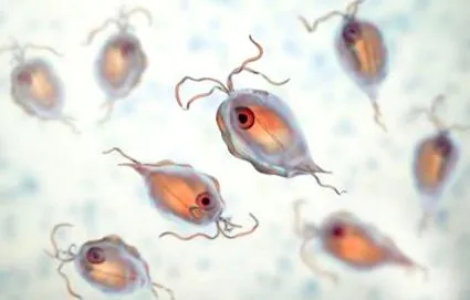 diagnostic tricomoniaza