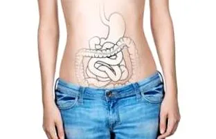 diverticulitis