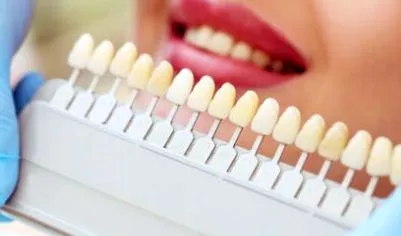 dentare